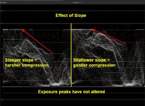 Slopes example.jpg