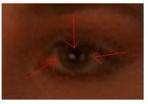 eyeball.JPG