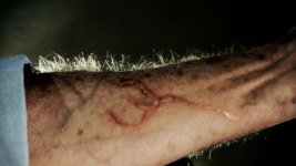 arm.jpg