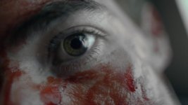 Effluvium eyeball.jpg