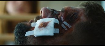 injured_1.44.2.jpg