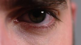 af100_eye.jpg
