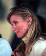 cameron diaz bad skin.jpg
