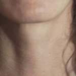 detail_skin_leeming.jpg detail_skin_leeming.jpg