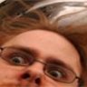 Aneurysm